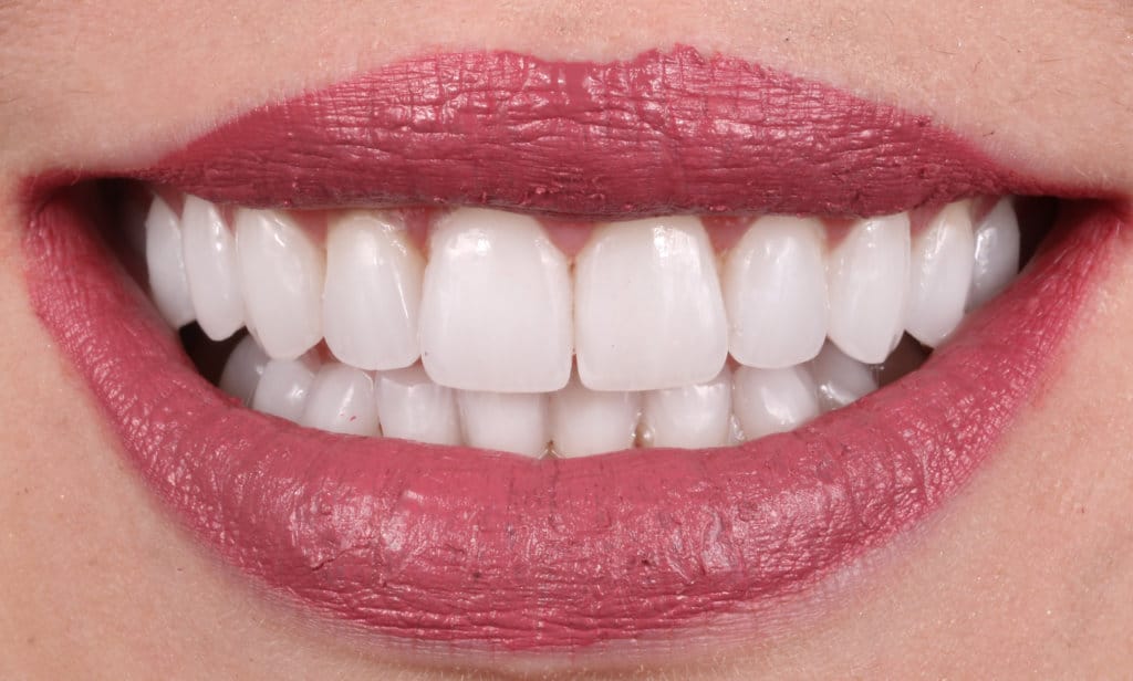 Digital Smile Design