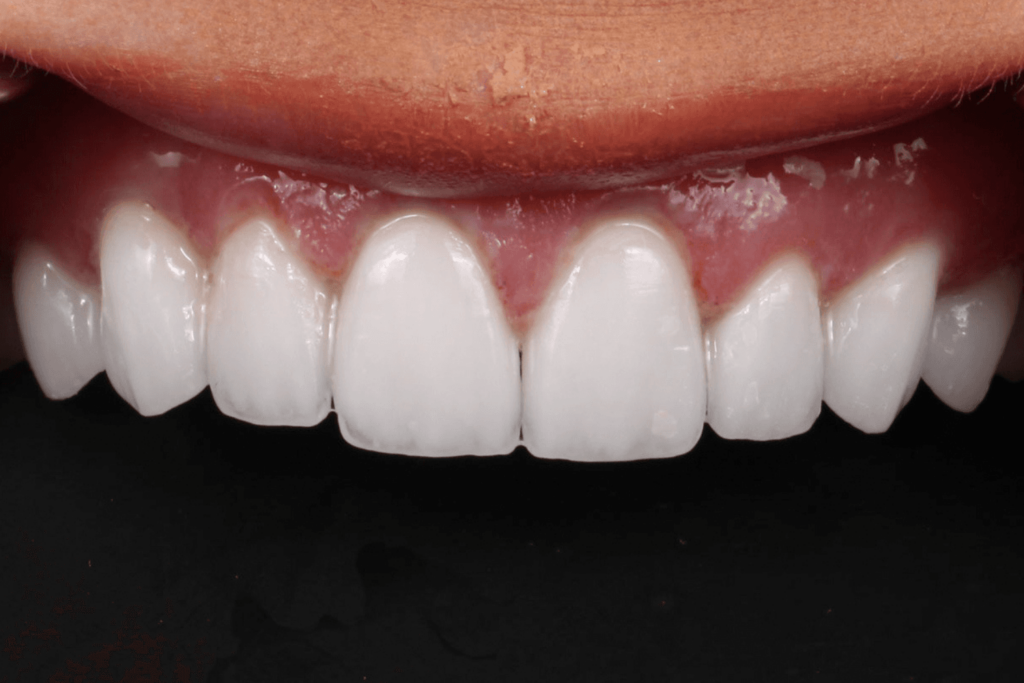 Psychology of Smiling