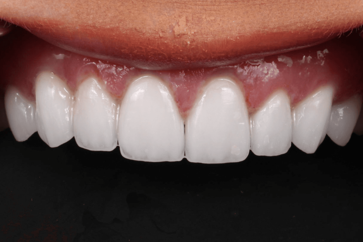 Psychology of Smiling