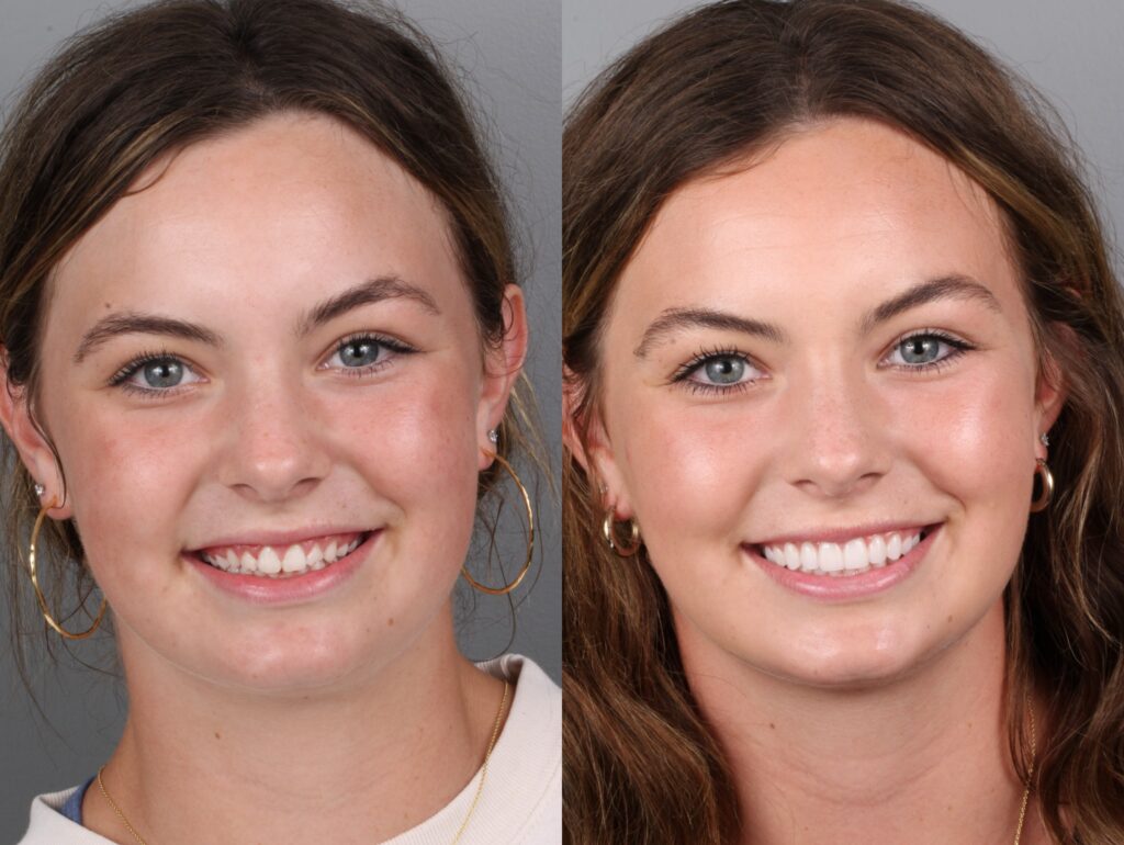 Aubrey Meis Headshot