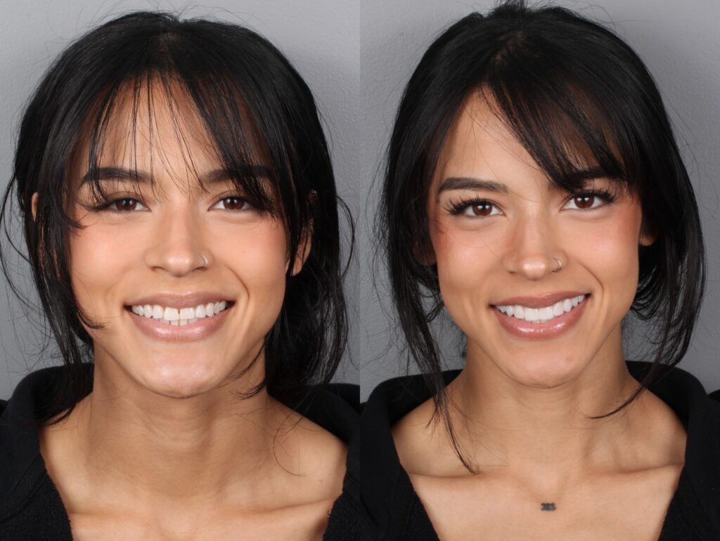 Deidra Before and After