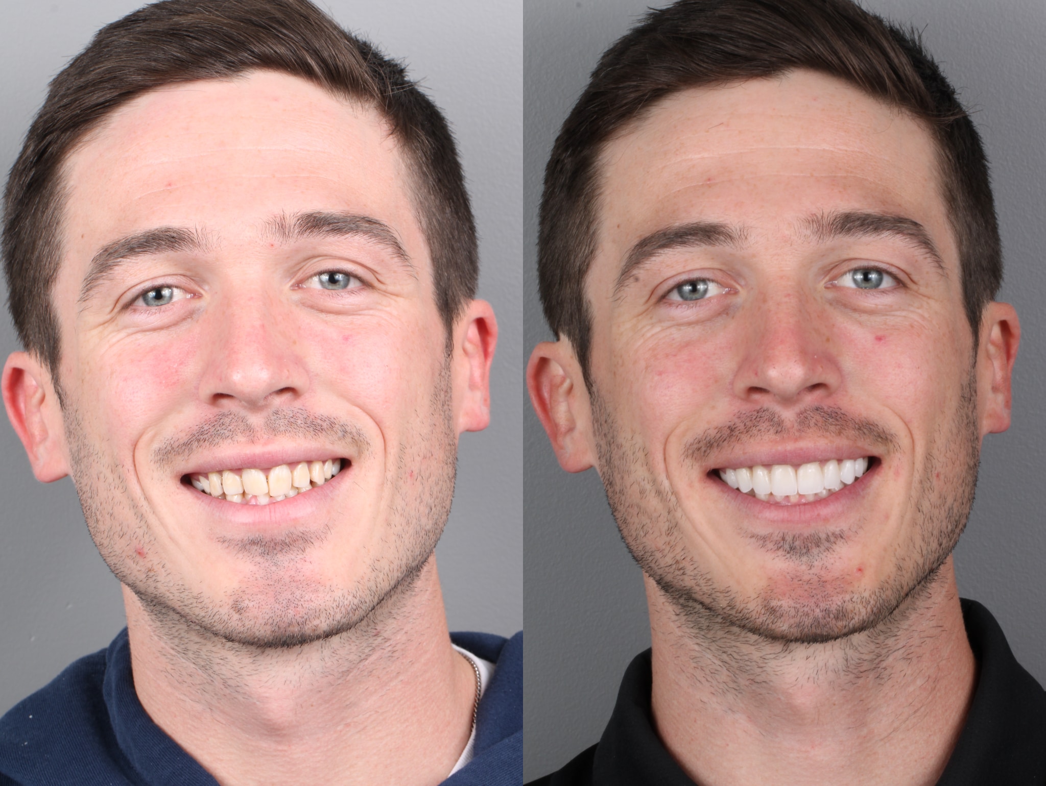 Gage Before and After Headshots