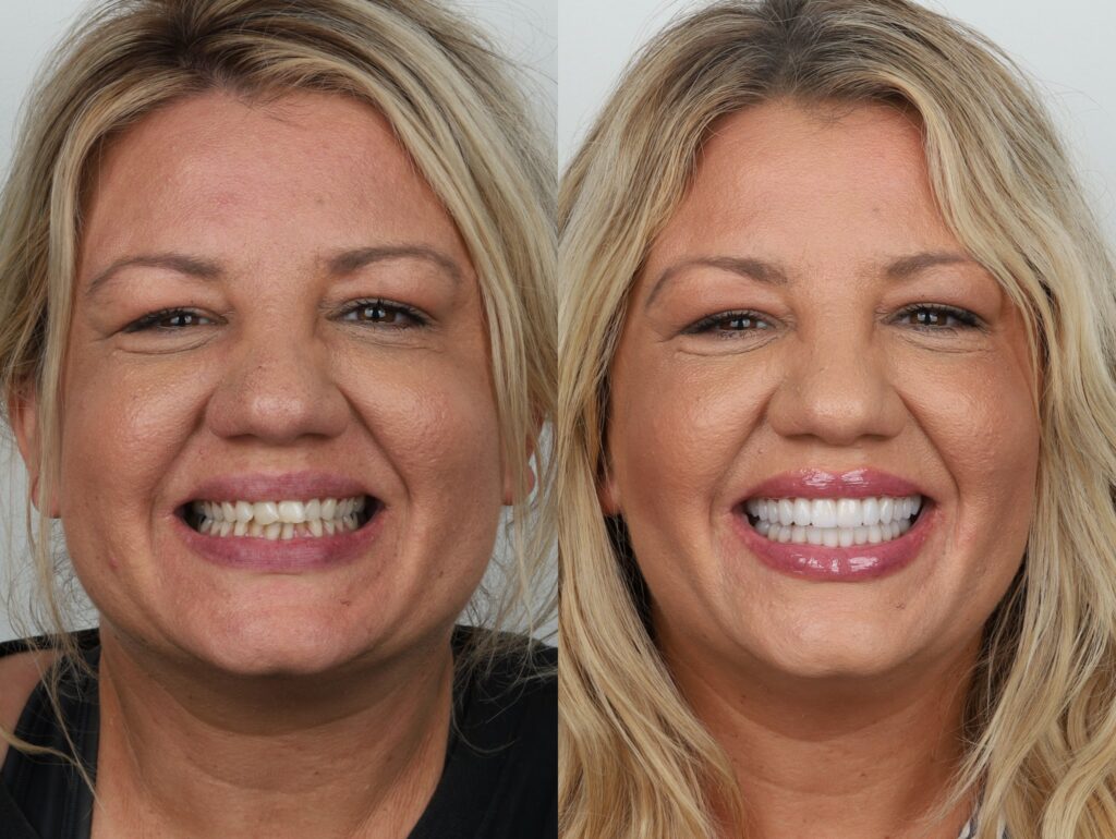 Jamie Before and After Headshots
