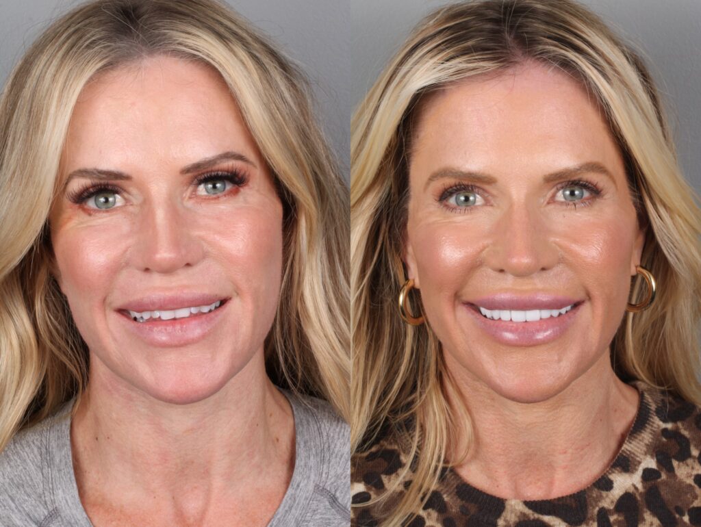 Jenn Before and After Headshots