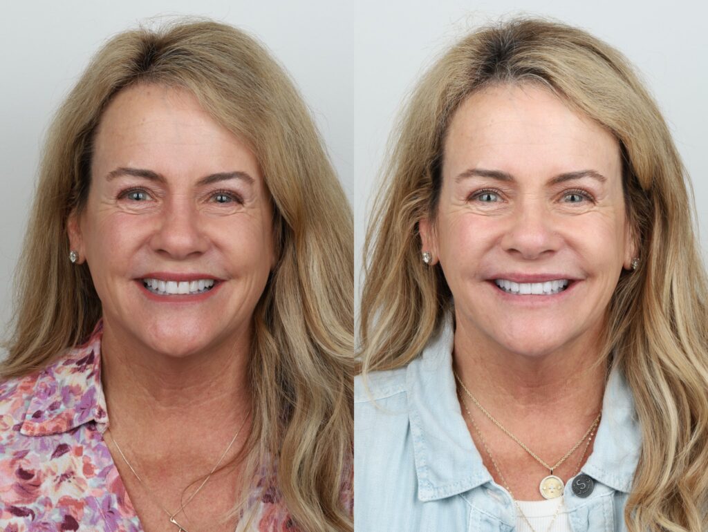 Joanie Before and After Headshots