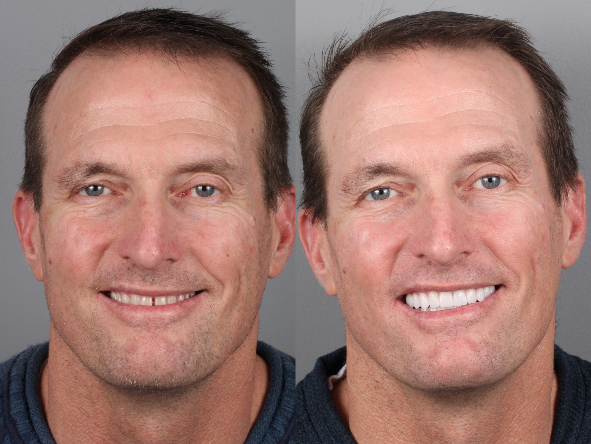 John K Before and After Headshots