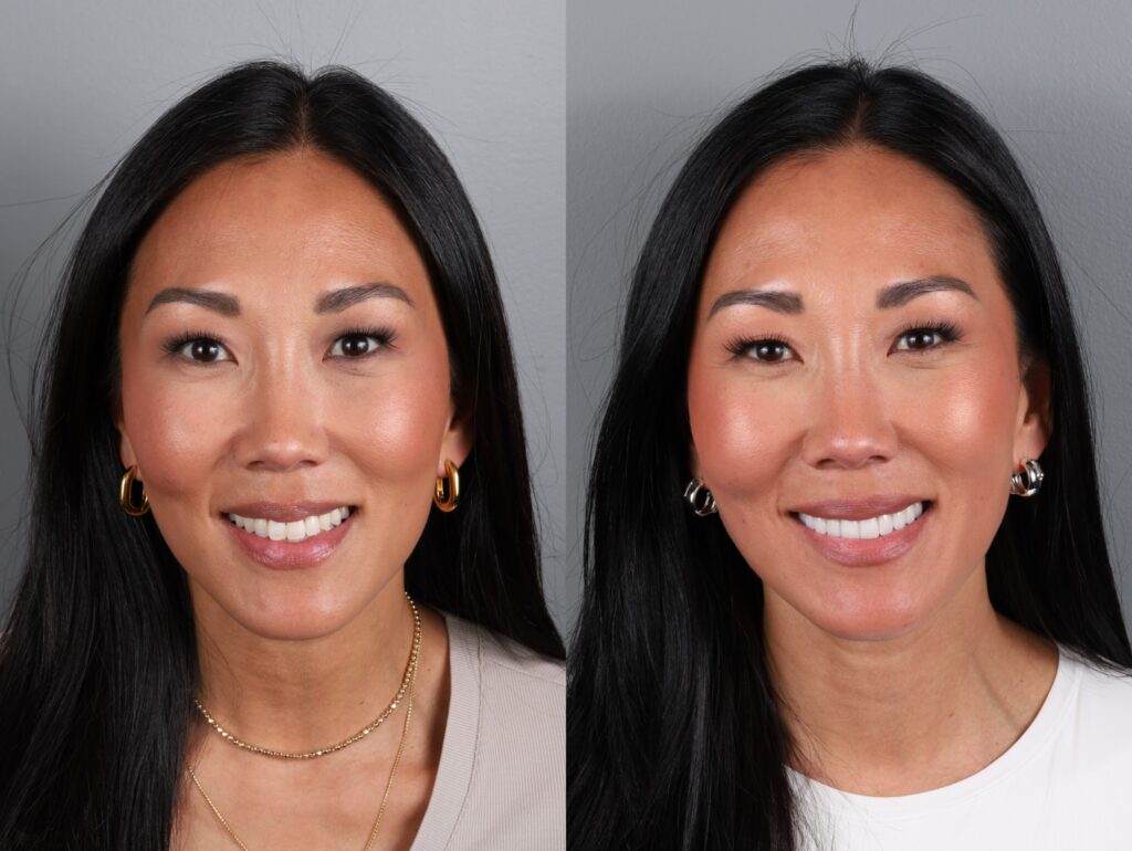 Katie Before and After Headshots