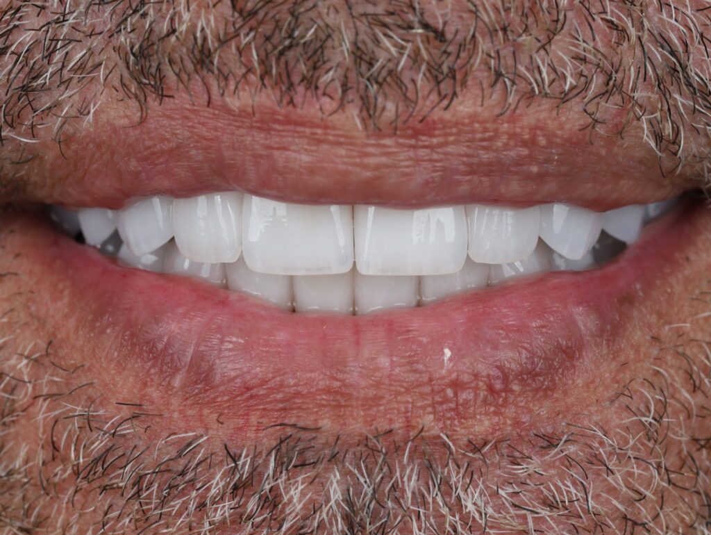 After