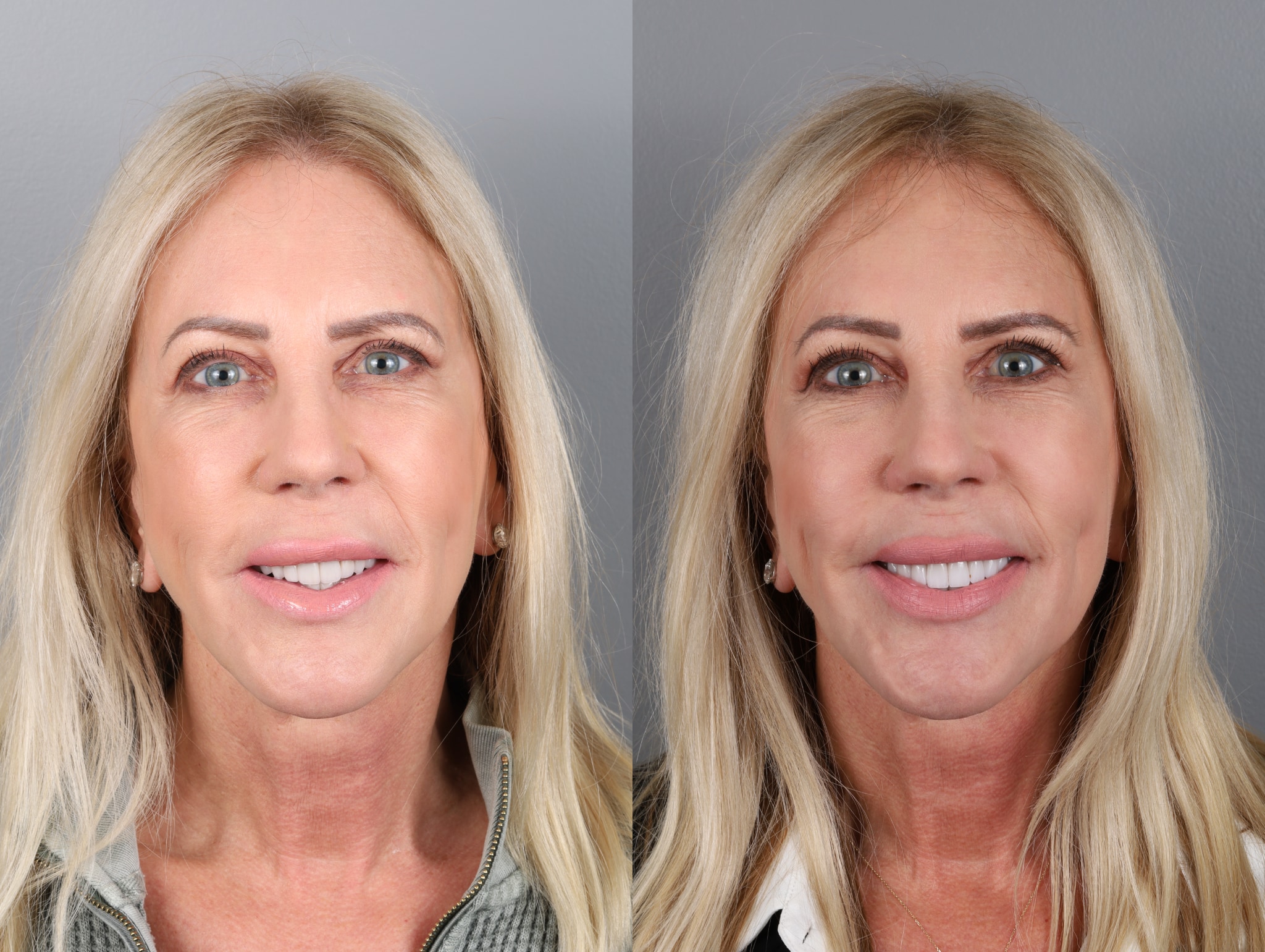 Vicki Before and After Headshots