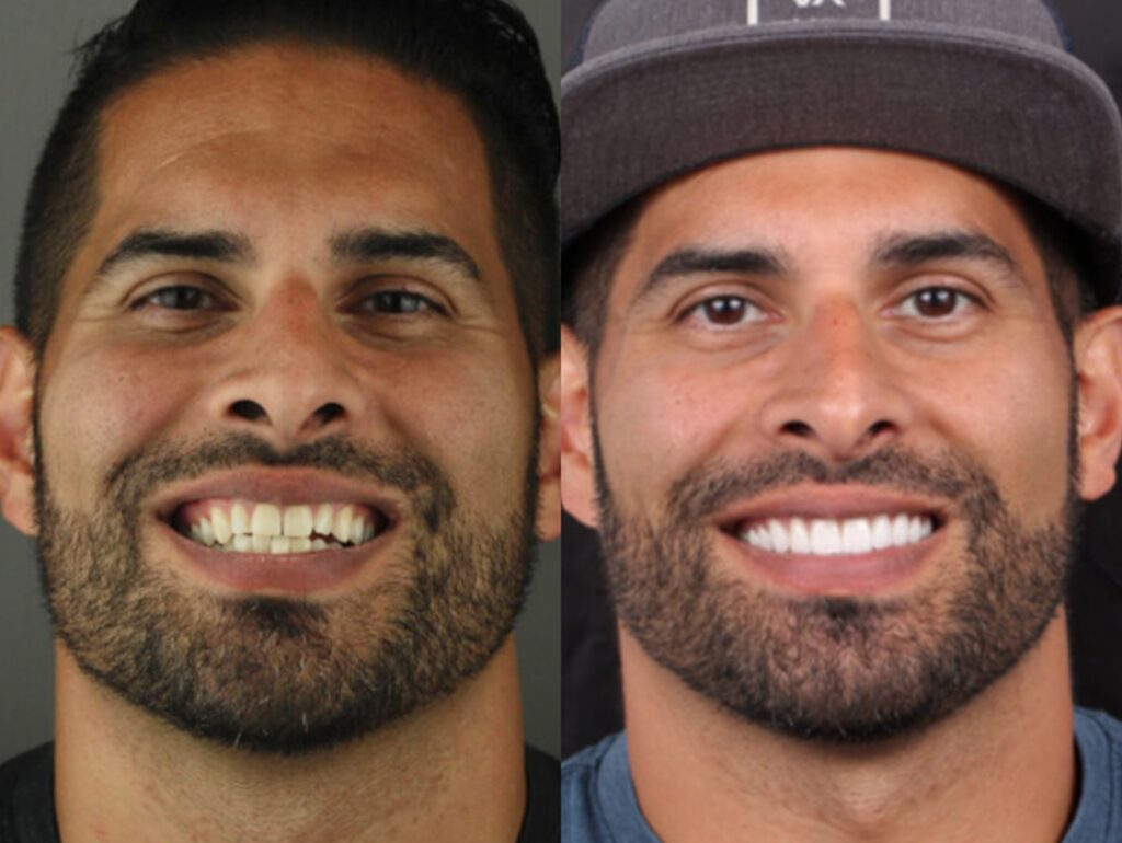 Before and After Headshot